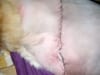 My Amputation Surgery Stitches