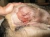 Wyatt drainage incision