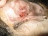 Wyatt drainage incision
