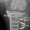 Remaining Limb Surgery Recovery for Tripawds Tripawd, dog, TPLO, recovery, surgery