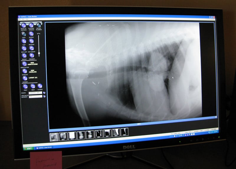 Digital chest x-ray shows reduction of osteosarcoma lung metastasis