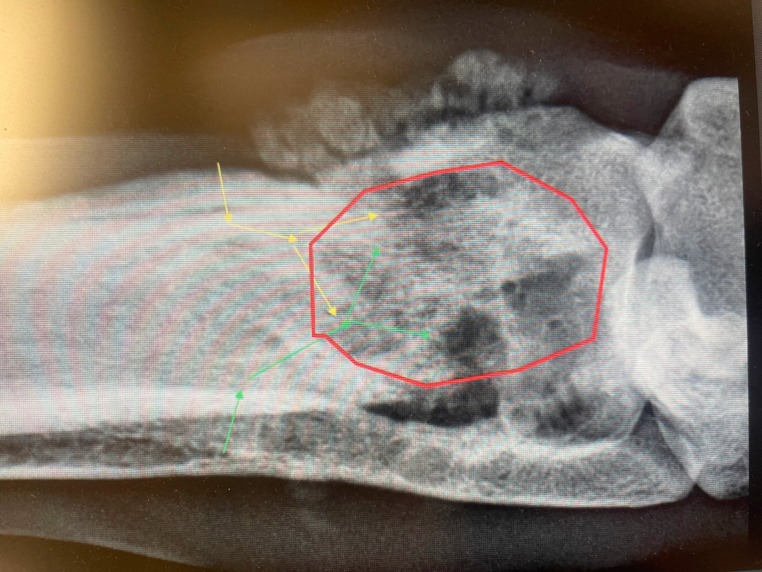Colt's osteosarcoma leg tumor radiograph.