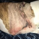 Bulldog seroma incision