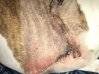 Bulldog seroma incision