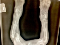 Tripawd Phoebe Broken Leg x-ray