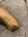 Partial dog leg amputation sore