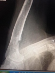 Canine Osteosarcoma Radiograph