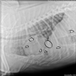 Lung Metastasis